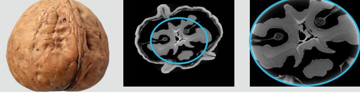 微型CT成像图片.jpg